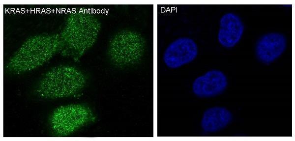 Immunofluorescent analysis of Hela cells, using KRAS+HRAS+NRAS Antibody