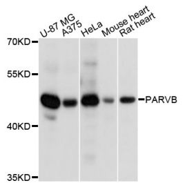 Anti-Beta-parvin PARVB Antibody