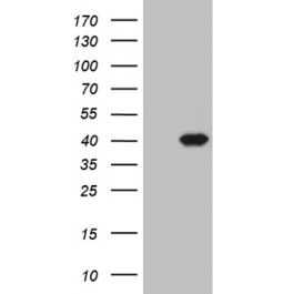 ご確認 m02718-anti-zinc-alpha-2-