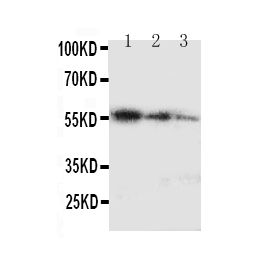 Anti Ki67 Mki67 Antibody