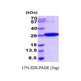 schistosoma japonicum Glutathione S-Transferase/GST Recombinant Protein schistosoma japonicum Glutathione S-Transferase/GST Recombinant Protein