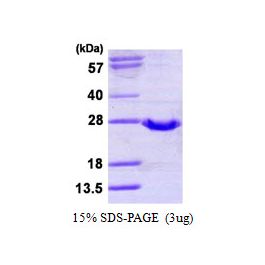 precursor to glutathione production N-Acetyl Cysteine (Glutathione Precursor)