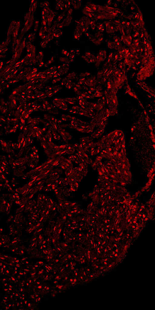 Mef2a was detected in a cryosection of zebrafish heart using the rabbit anti-Mef2a antibody (cat# DZ01398-1, 1:200, 4°C overnight). AlexaFluo546 Conjugated Goat Anti-Rabbit IgG was used as secondary antibody at 1:200 dilution and incubated for 1.5 h at room temperature.