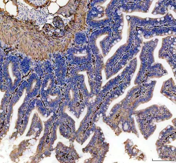 dz02695 cavin1b primary antibodies ihc testing 4