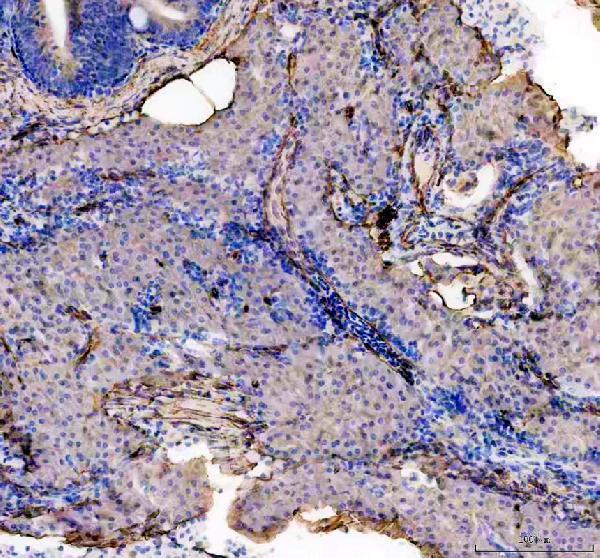 dz02695 cavin1b primary antibodies ihc testing 5