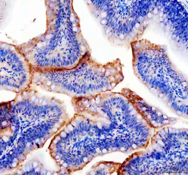 dz06456 pxdn primary antibodies ihc testing 1