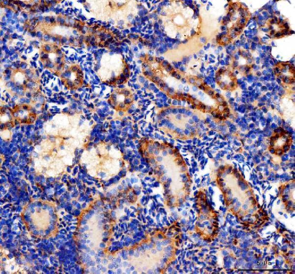 dz07988 cdhr1a primary antibodies ihc testing 3