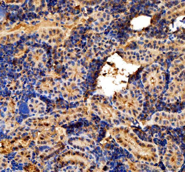 dz33948 cavin4a primary antibodies ihc testing 2