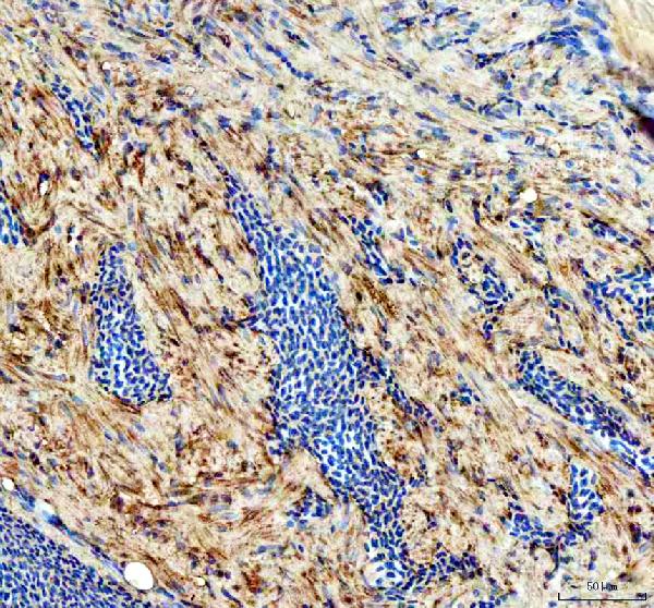 dz33959 cavin1a primary antibodies ihc testing 3