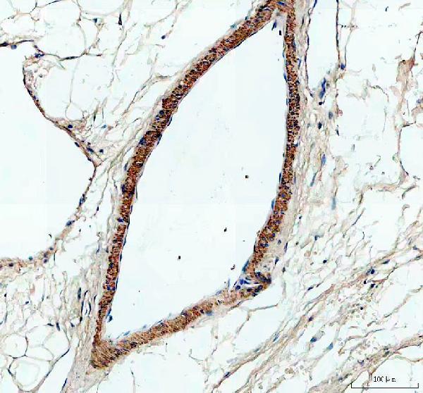  IHC analysis of Peroxidasin homolog isoform X1 using anti-Peroxidasin homolog isoform X1 antibody (DZ33984)