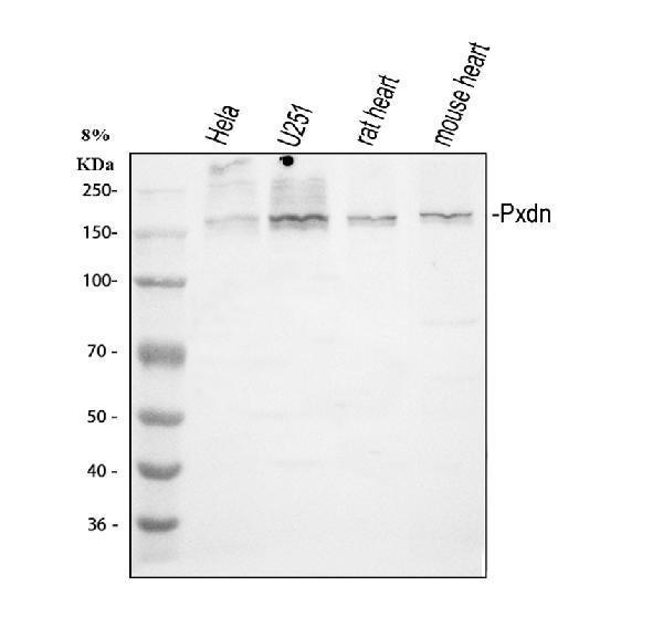  Western blot analysis of Peroxidasin homolog isoform X1 using anti-Peroxidasin homolog isoform X1 antibody (DZ33984)