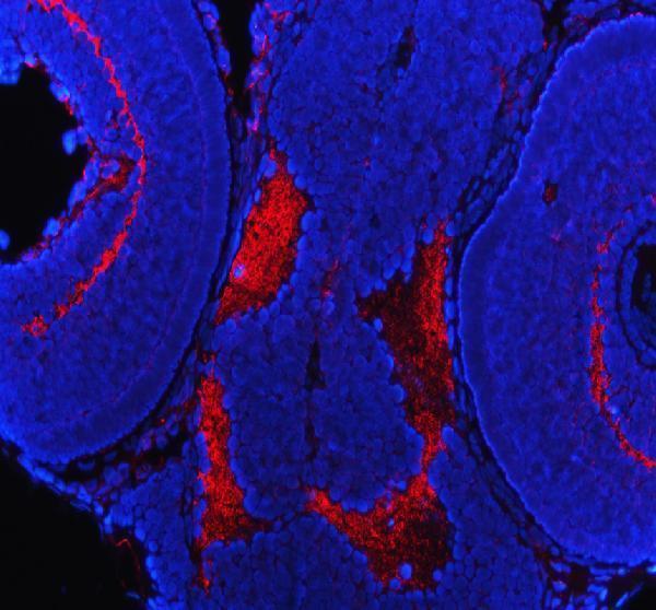 dz41027 ptprq primary antibodies if testing 6