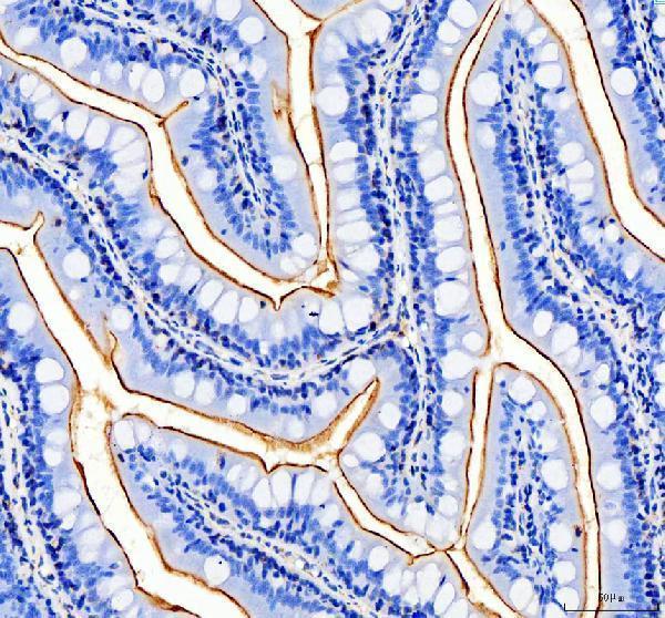 dz41027 ptprq primary antibodies ihc testing 1
