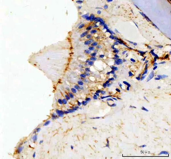 dz41027 ptprq primary antibodies ihc testing 2