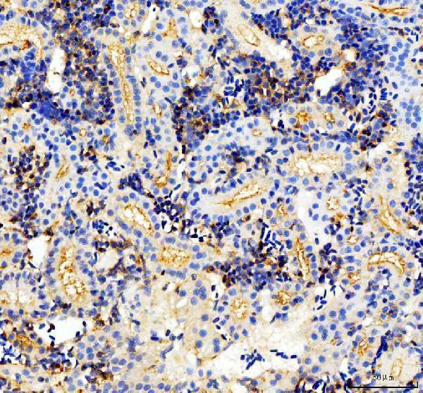 dz41027 ptprq primary antibodies ihc testing 3