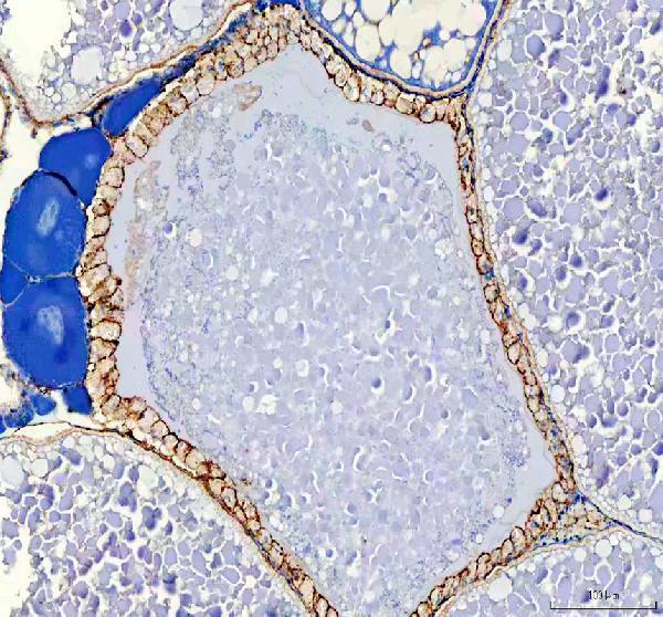 dz41027 ptprq primary antibodies ihc testing 4