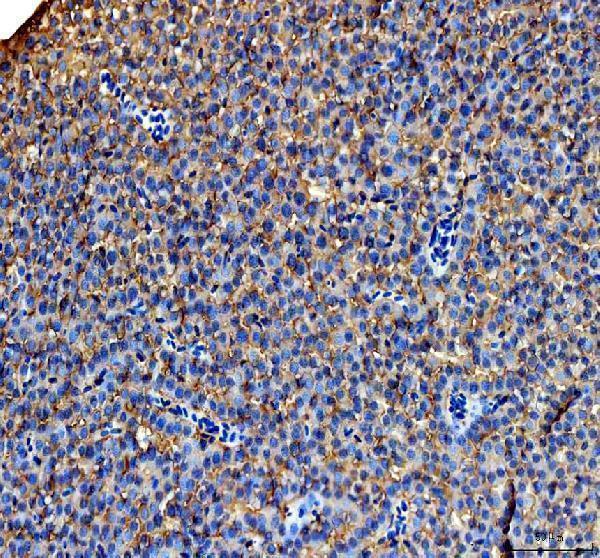  IHC analysis of Hgd using anti-Hgd antibody (DZ41116)