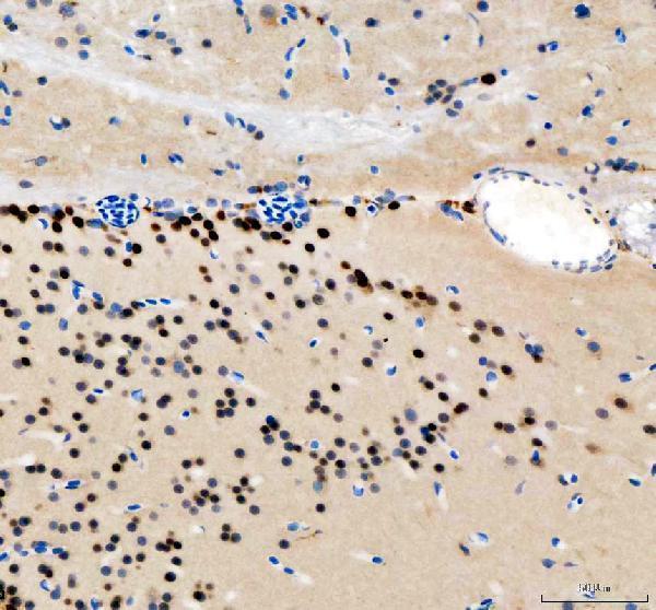  IHC analysis of Tfap2a using anti-Tfap2a antibody (DZ41119)