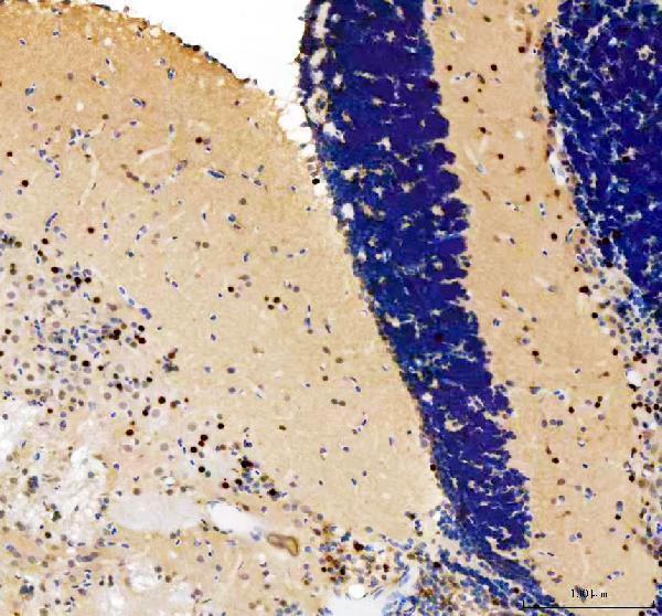 dz41119 tfap2a primary antibodies ihc testing 3