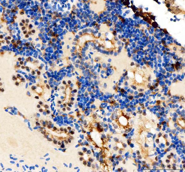 dz41119 tfap2a primary antibodies ihc testing 4