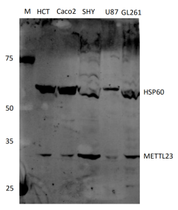 Figure 1. Western blot analysis of METTL23 using anti-METTL23 antibody (DZ41142). Electrophoresis was performed on a 5-20% SDS-PAGE gel at 70V (Stacking gel) / 90V (Resolving gel) for 2-3 hours. The sample well of each lane was loaded with 30ug of sample under reducing conditions. Lane 1: human HCT whole cell lysates, Lane 2: human Caco-2 whole cell lysates, Lane 3: human SHY whole cell lysates, Lane 4: human U87 whole cell lysates, Lane 5: mouse GL261 whole cell lysates. After Electrophoresis, proteins were transferred to a PVDF membrane at 150mA for 50-90 minutes. Blocked the membrane with 5% Non-fat Milk/ TBS for 1.5 hour at RT. The membrane was incubated with rabbit anti-METTL23 antigen affinity purified polyclonal antibody (Catalog # DZ41142) at 0.5 microg/mL overnight at 4°C, then washed with TBS-0.1%Tween 3 times with 5 minutes each and detected by Licor IR800 rabbit antibody at a dilution of 1:5000 for 1.5 hour at RT. The signal is developed using an Enhanced Chemiluminescent detection (ECL) kit (Catalog # EK1002)?with Tanon 5200 system.