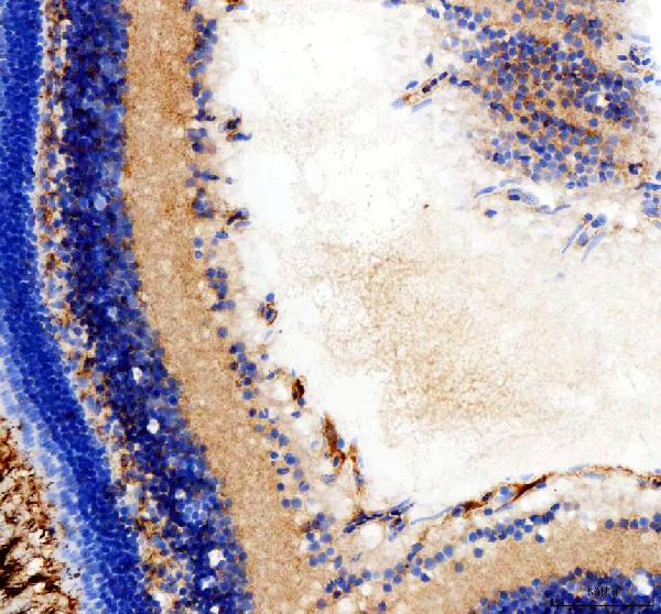 dz41147 hsd17b14 primary antibodies ihc testing 1