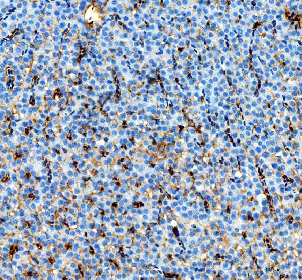 dz41147 hsd17b14 primary antibodies ihc testing 2