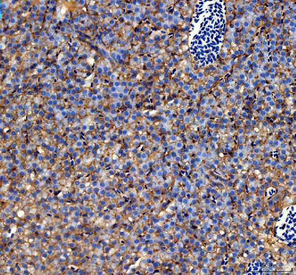  IHC analysis of Cemip using anti-Cemip antibody (DZ41148)