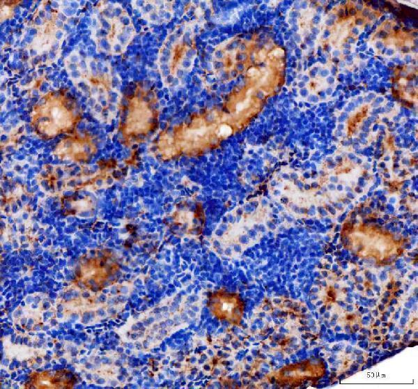 dz41186 zgc_153521 primary antibodies ihc testing 1