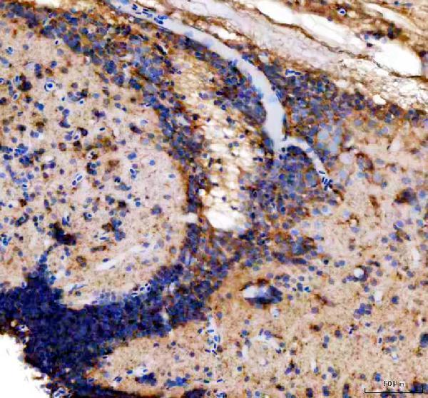 dz41186 zgc_153521 primary antibodies ihc testing 2