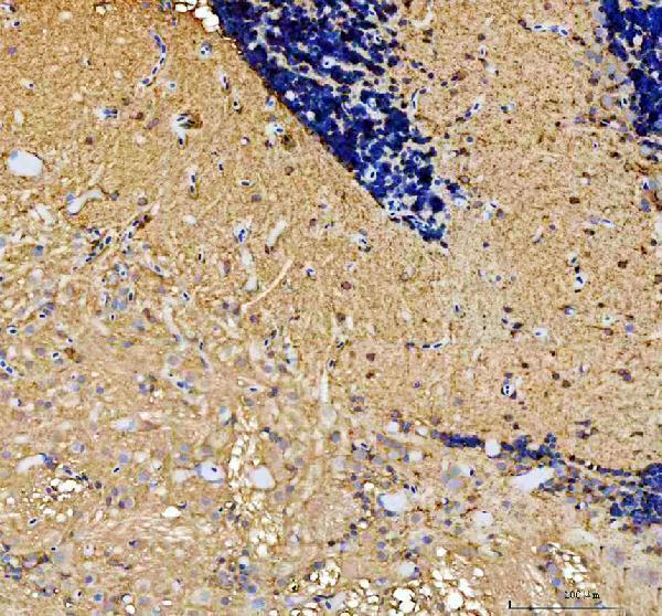 dz41226 pcdh15b primary antibodies ihc testing 2