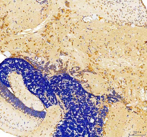 dz41229 snai1b primary antibodies ihc testing 1