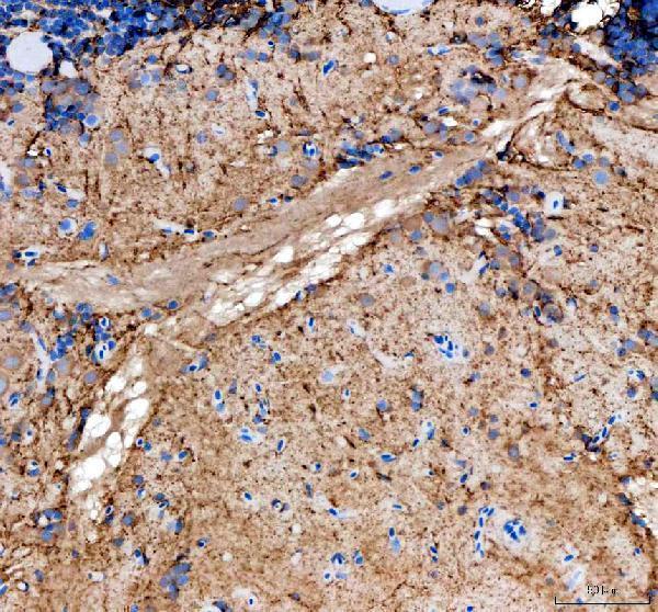 dz41230 timp2a primary antibodies ihc testing 1