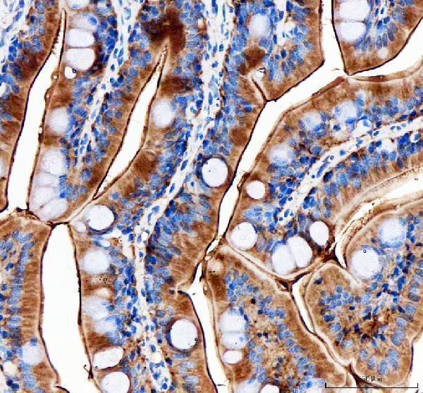 dz41230 timp2a primary antibodies ihc testing 2