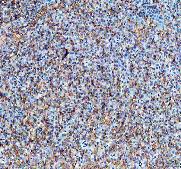 dz41230 timp2a primary antibodies ihc testing 3
