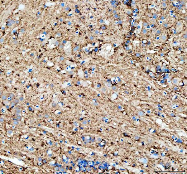 dz41230 timp2a primary antibodies ihc testing 4