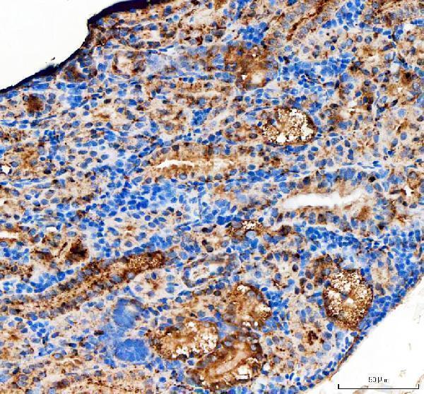 dz41230 timp2a primary antibodies ihc testing 5_1