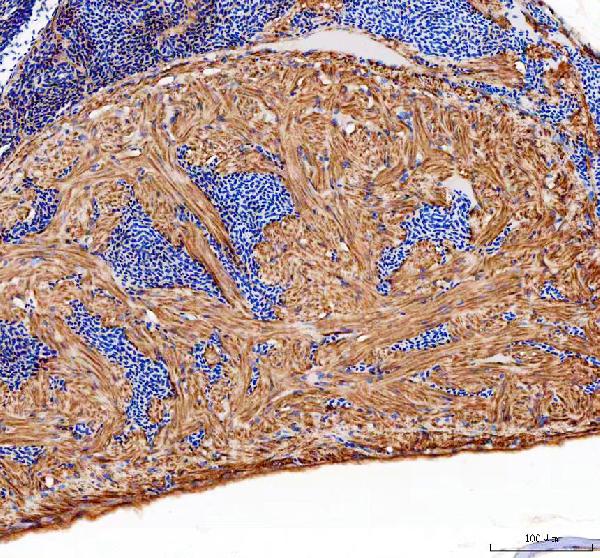 dz41233 dusp4 primary antibodies ihc testing 1