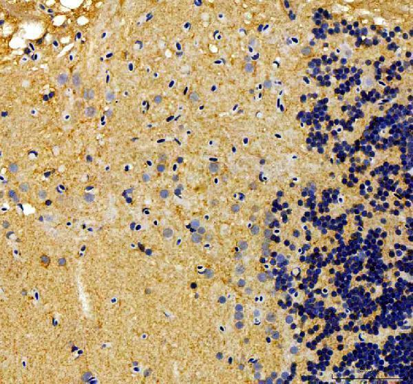 dz41261 alk primary antibodies ihc testing 1