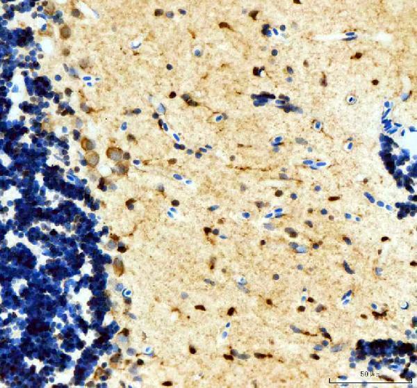  IHC analysis of Tyrosine Hydrxylase/Th using anti-Tyrosine Hydrxylase/Th antibody (DZ41285)