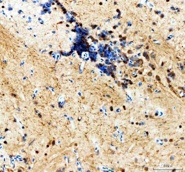 dz41285 th primary antibodies ihc testing 3