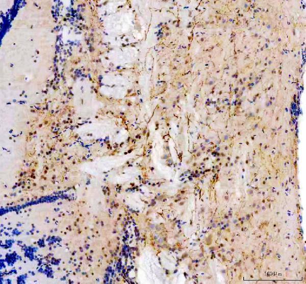 IHC analysis of Tyrosine Hydrxylase/Th using anti-Tyrosine Hydrxylase/Th antibody (DZ41285)