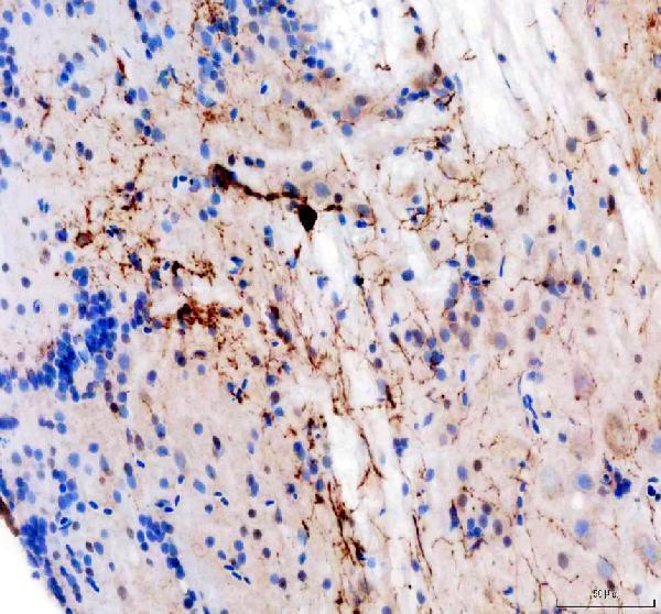 dz41285 th primary antibodies ihc testing 5