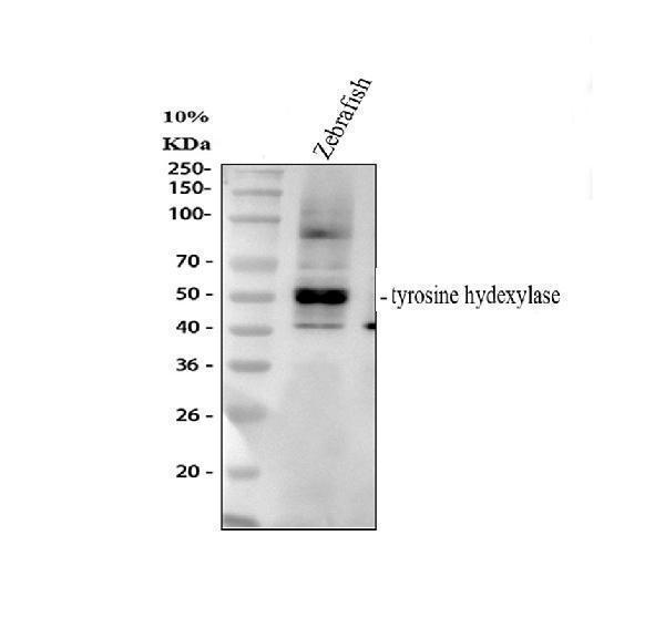  Western blot analysis of Tyrosine Hydrxylase/Th using anti-Tyrosine Hydrxylase/Th antibody (DZ41285)