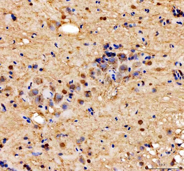 dz41294 casc3 primary antibodies ihc testing 2