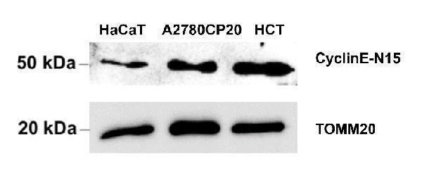Western blot analysis of CCNE1 using anti-CCNE1 antibody (DZ41310)