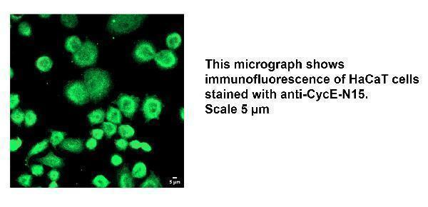 IF analysis of CCNE1 using anti-CCNE1 antibody (DZ41310)