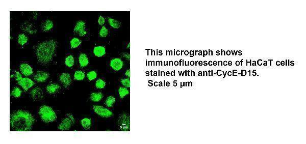 IF analysis of CCNE1 using anti-CCNE1 antibody (DZ41311)