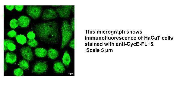 IF analysis of CCNE1 using anti-CCNE1 antibody (DZ41312)
