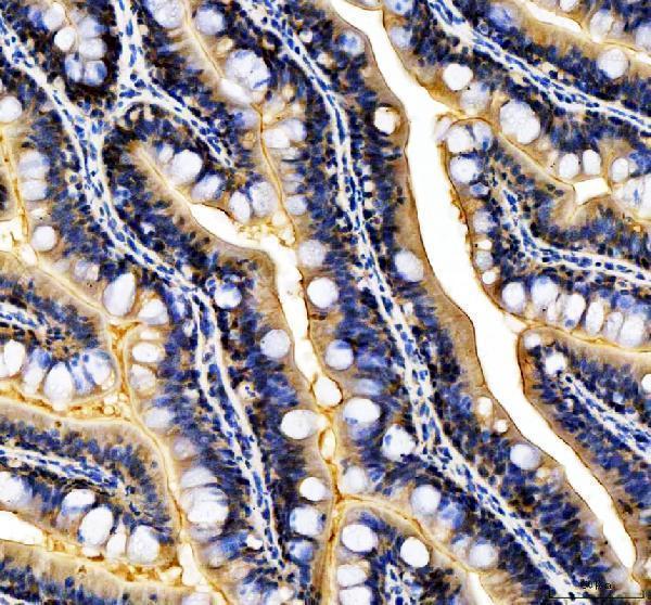 dz41378 tmem242 primary antibodies ihc testing 1